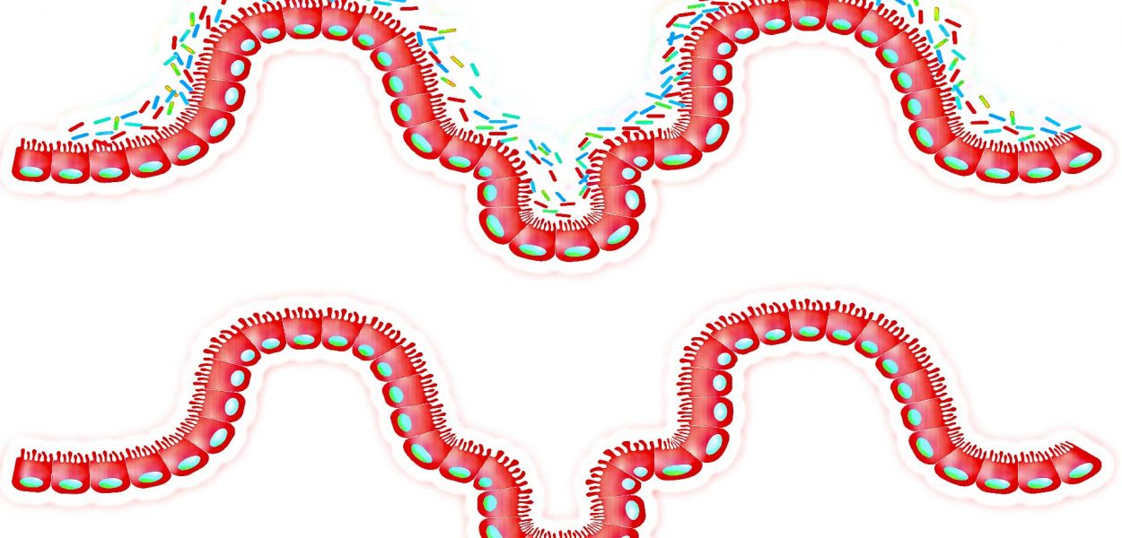 Microbiota intestino