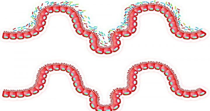 Microbiota intestino